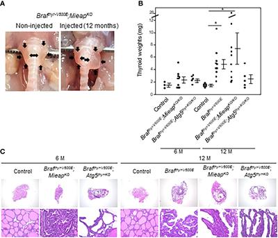 MIEAP and ATG5 are tumor suppressors in a mouse model of BRAFV600E-positive thyroid cancer